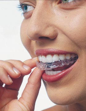 шини в стоматологията